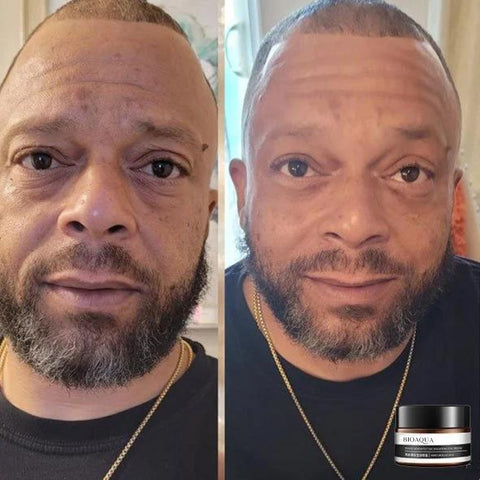EverYouth Krém proti stárnutí – Hladší pokožka a svěžejší pleť, 50 ml