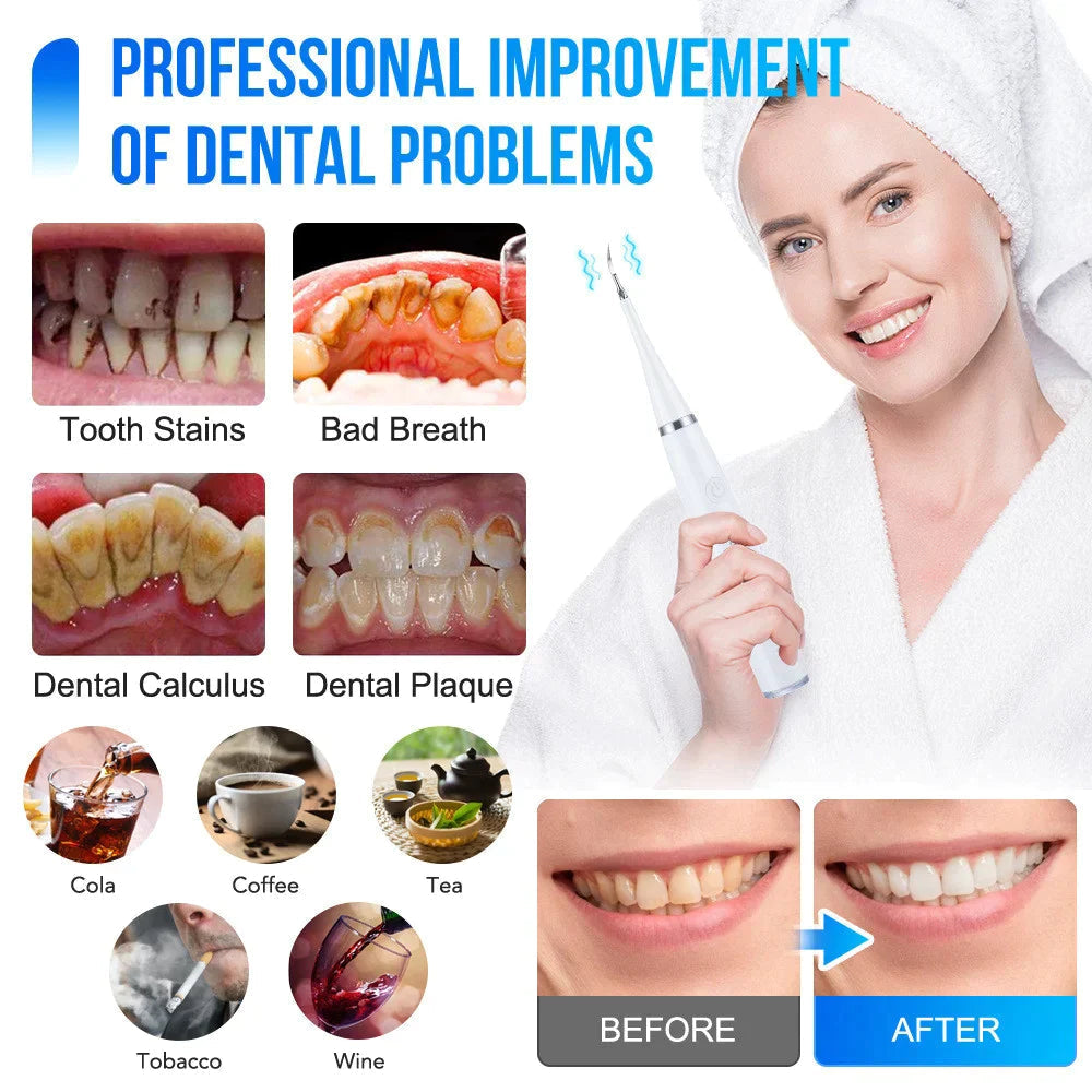 ToothCleaner – Ultrazvukový čistič zubov pre dôkladnú starostlivosť o zuby