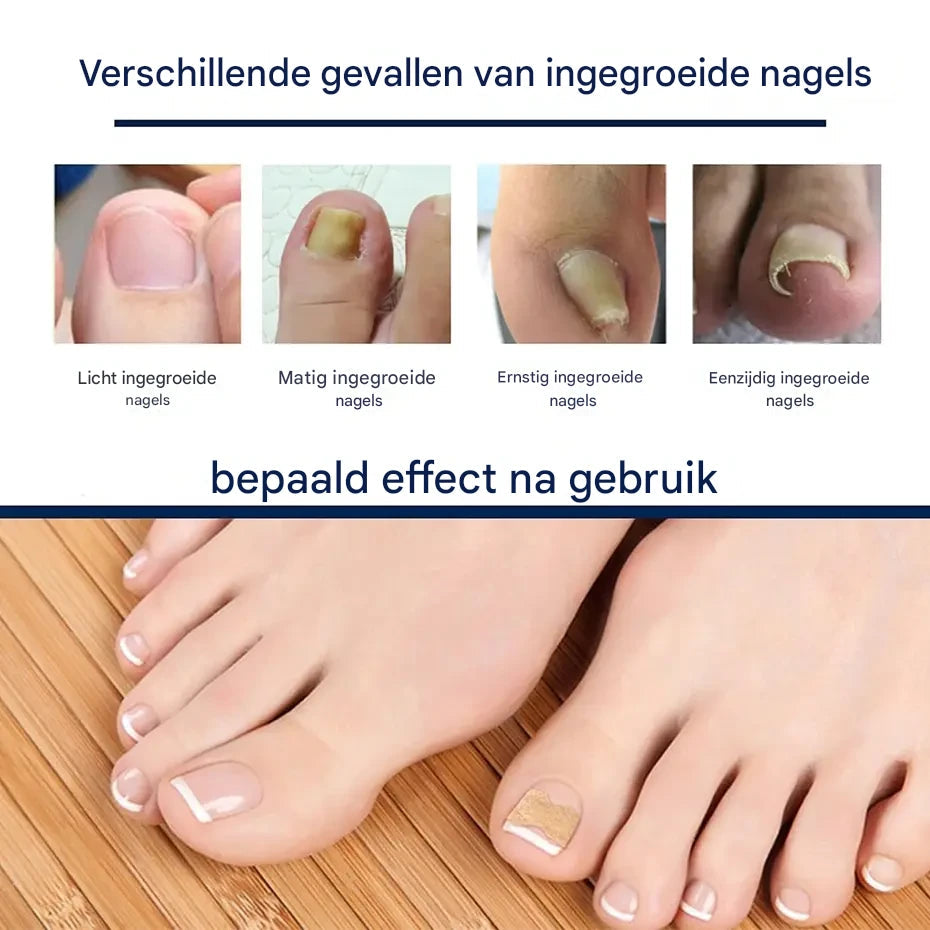 HealthyNail Nagelpolster – 50 Stück für gepflegte und formschöne Nägel