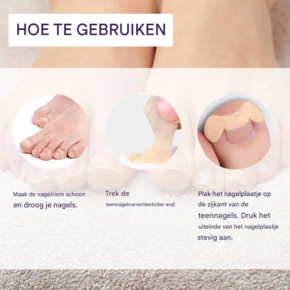 HealthyNail Nagelpolster – 50 Stück für gepflegte und formschöne Nägel