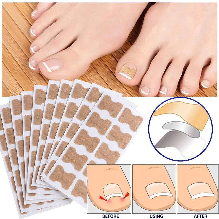 HealthyNail Nagelpolster – 50 Stück für gepflegte und formschöne Nägel