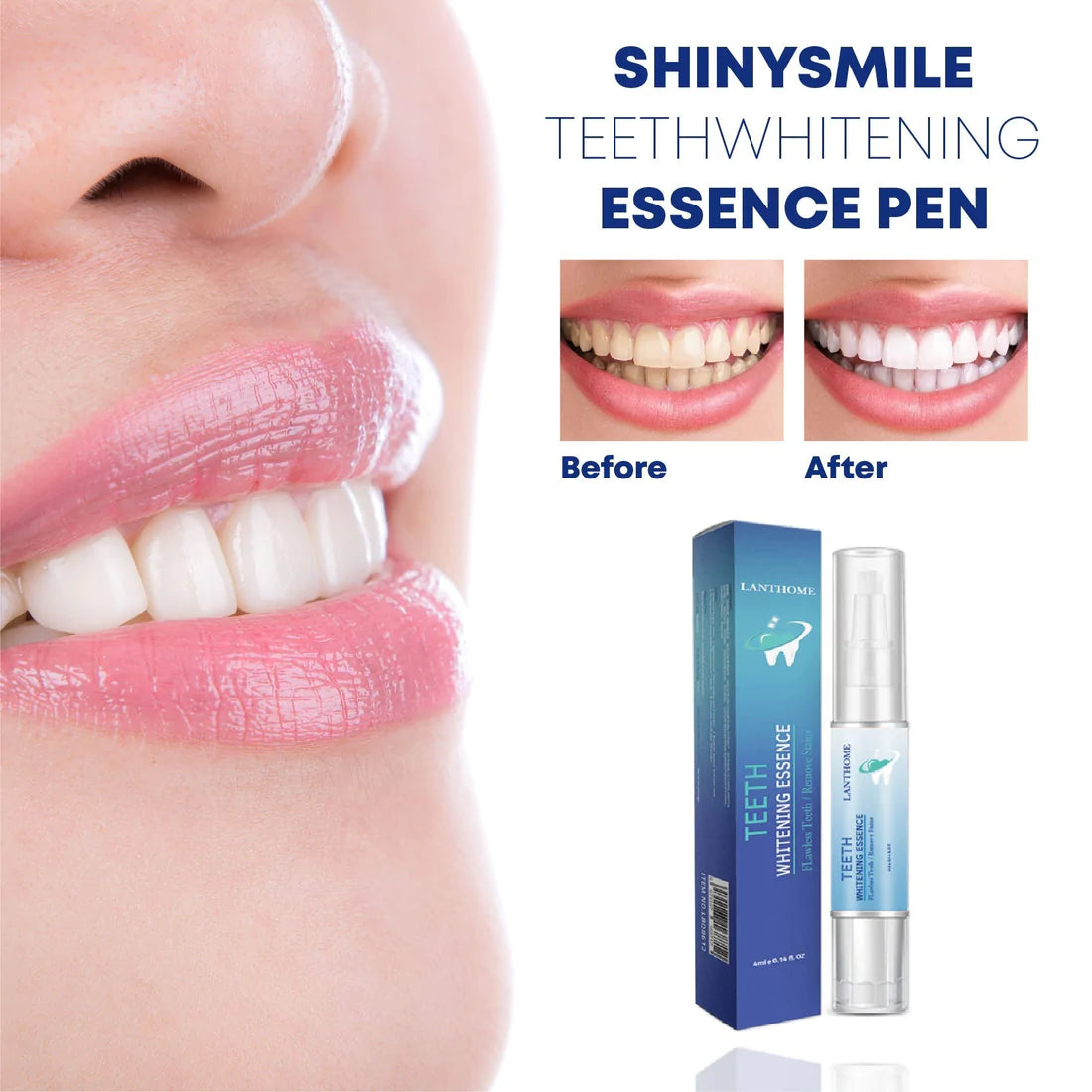 BrightSmile Whitening Essence – Für strahlend helle Zähne, 50 ml