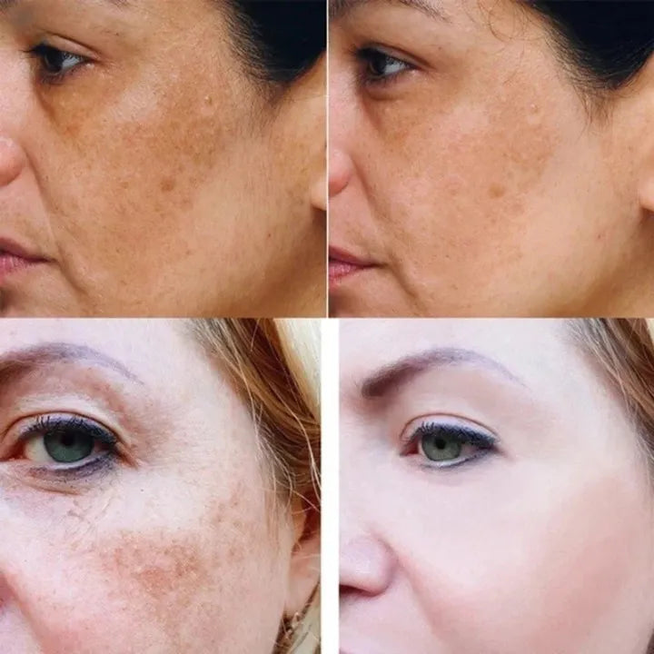 Herbavie – Kurkuma Serum gegen dunkle Flecken – für strahlende Haut